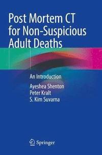 bokomslag Post Mortem CT for Non-Suspicious Adult Deaths