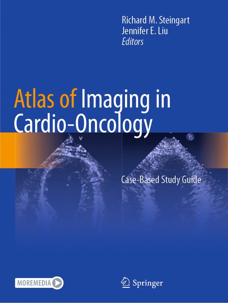 Richard M. Steingart, Jennifer E. Liu - Atlas of Imaging in Cardio-Oncology, Häftad