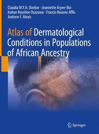 bokomslag Atlas of Dermatological Conditions in Populations of African Ancestry