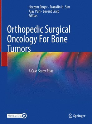 Orthopedic Surgical Oncology For Bone Tumors 1