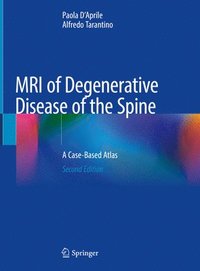 bokomslag MRI of Degenerative Disease of the Spine