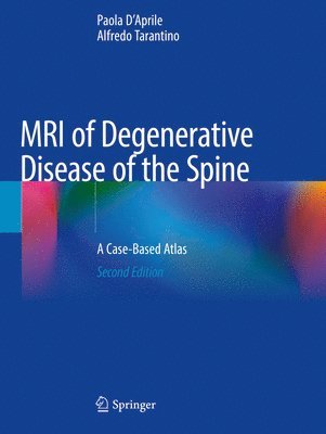 bokomslag MRI of Degenerative Disease of the Spine