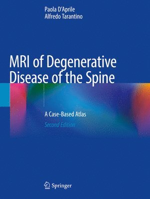 MRI of Degenerative Disease of the Spine