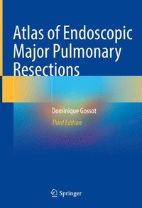 bokomslag Atlas of Endoscopic Major Pulmonary Resections