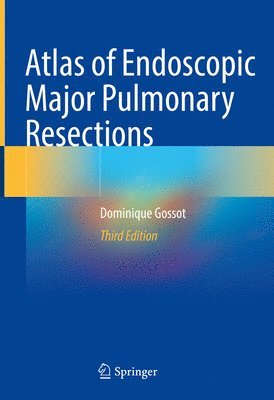 Atlas of Endoscopic Major Pulmonary Resections 1