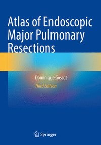 bokomslag Atlas of Endoscopic Major Pulmonary Resections