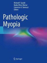 bokomslag Pathologic Myopia