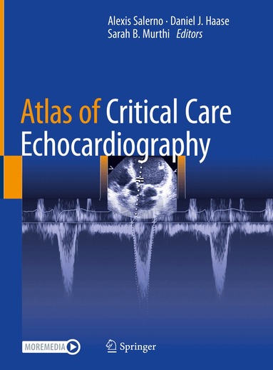 Alexis Salerno, Daniel J. Haase, Sarah B. Murthi - Atlas of Critical Care Echocardiography, Inbunden
