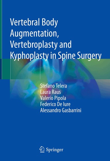 Stefano Telera, Laura Raus, Valerio Pipola, Federico De Iure, Alessandro Gasbarrini - Vertebral Body Augmentation, Vertebroplasty and Kyphoplasty in Spine Surgery, Inbunden