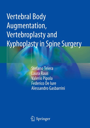 Stefano Telera, Laura Raus, Valerio Pipola, Federico De Iure, Alessandro Gasbarrini - Vertebral Body Augmentation, Vertebroplasty and Kyphoplasty in Spine Surgery, Häftad