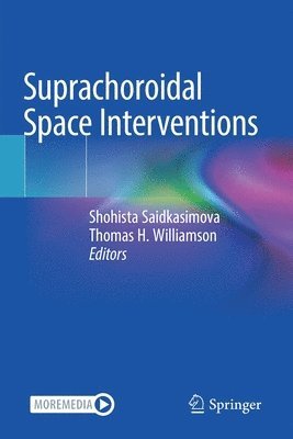 Suprachoroidal Space Interventions 1