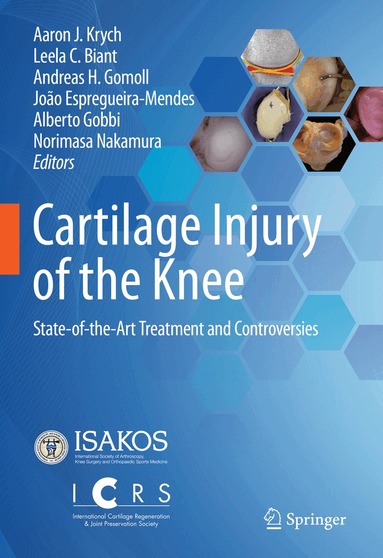 Aaron J. Krych, Leela C. Biant, Andreas H. Gomoll, João Espregueira-Mendes, Alberto Gobbi, Norimasa Nakamura - Cartilage Injury of the Knee, Inbunden