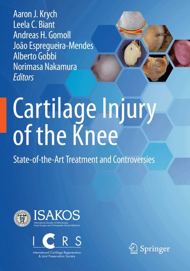 Aaron J. Krych, Leela C. Biant, Andreas H. Gomoll, João Espregueira-Mendes, Alberto Gobbi, Norimasa Nakamura - Cartilage Injury of the Knee, Häftad