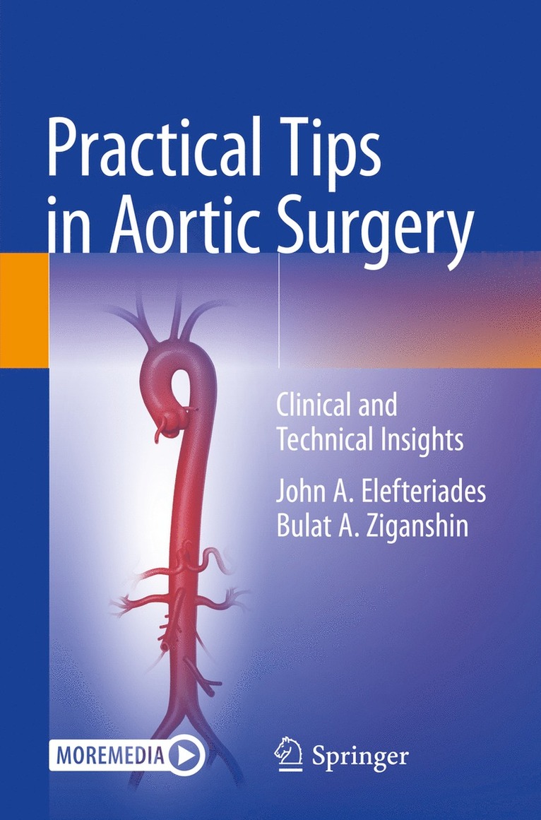 John A. Elefteriades, Bulat A. Ziganshin - Practical Tips in Aortic Surgery, Häftad