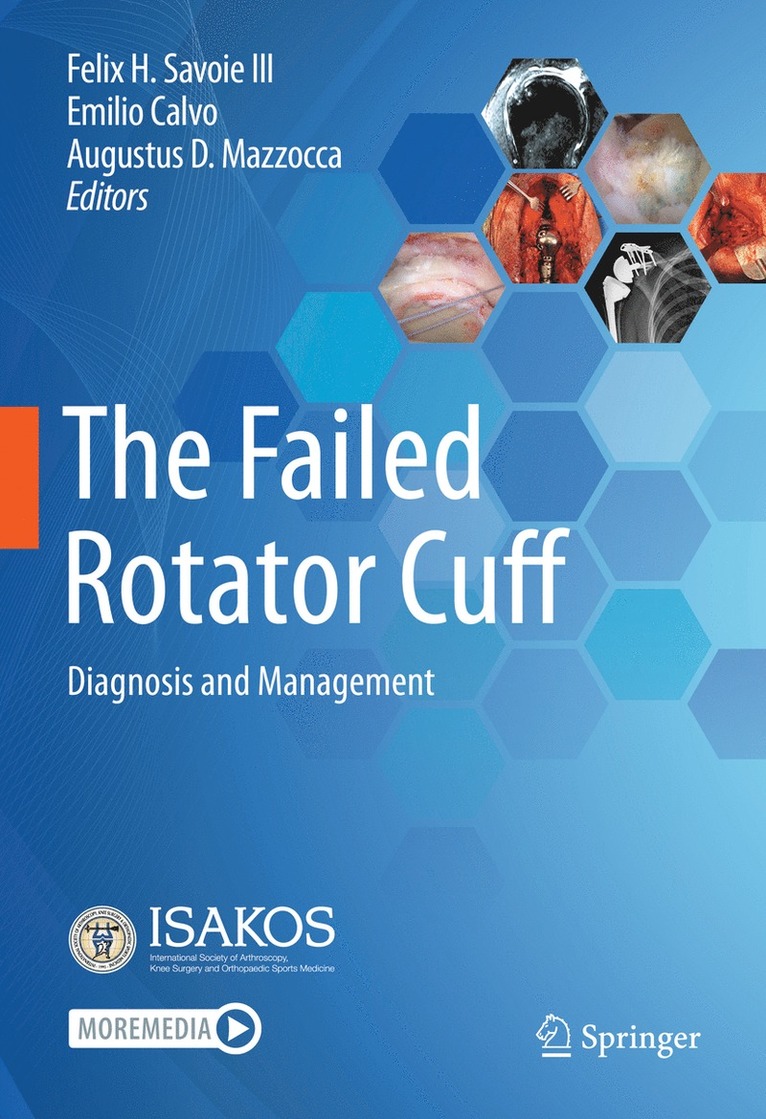 Felix H. Savoie III, Emilio Calvo, Augustus D. Mazzocca - Failed Rotator Cuff, Inbunden