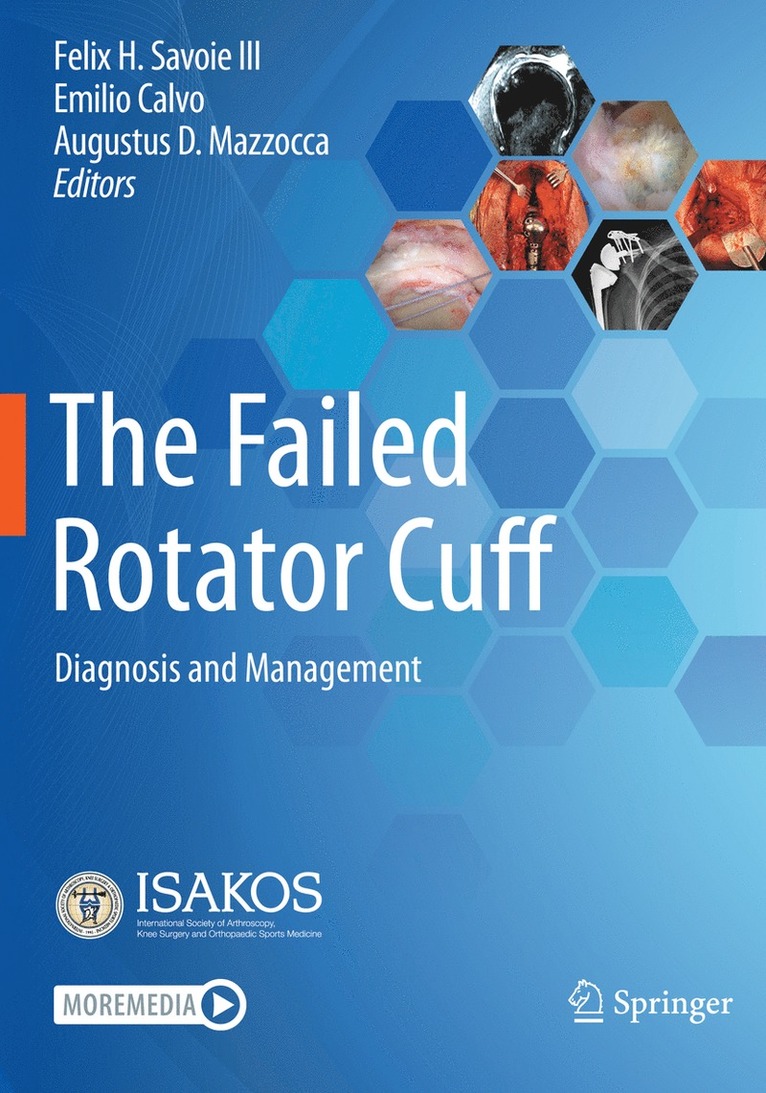 Felix H. Savoie III, Emilio Calvo, Augustus D. Mazzocca - Failed Rotator Cuff, Häftad
