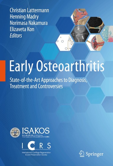 Christian Lattermann, Henning Madry, Norimasa Nakamura, Elizaveta Kon - Early Osteoarthritis, Inbunden