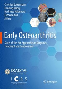 bokomslag Early Osteoarthritis