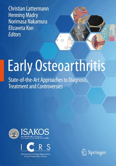 Christian Lattermann, Henning Madry, Norimasa Nakamura, Elizaveta Kon - Early Osteoarthritis, Häftad
