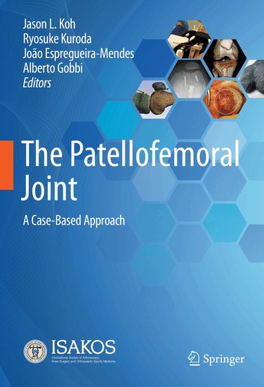 Jason L. Koh, Ryosuke Kuroda, João Espregueira-Mendes, Alberto Gobbi - Patellofemoral Joint, Inbunden