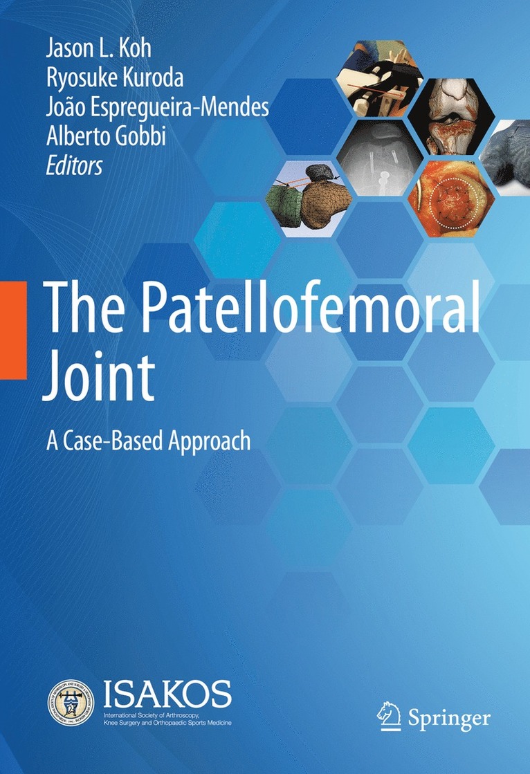 Jason L. Koh, Ryosuke Kuroda, João Espregueira-Mendes, Alberto Gobbi, Joao Espregueira-Mendes - Patellofemoral Joint, Inbunden