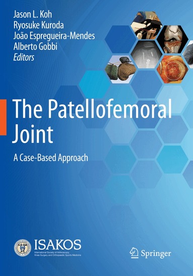Jason L. Koh, Ryosuke Kuroda, João Espregueira-Mendes, Alberto Gobbi - Patellofemoral Joint, Häftad