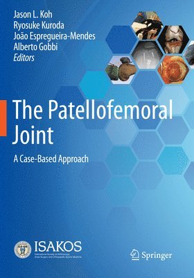 Jason L. Koh, Ryosuke Kuroda, João Espregueira-Mendes, Alberto Gobbi, Joao Espregueira-Mendes - Patellofemoral Joint, Häftad