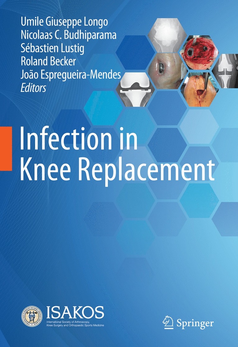 Umile Giuseppe Longo, Nicolaas C. Budhiparama, Sébastien Lustig, Roland Becker, João Espregueira-Mendes, Sebastien Lustig, Joao Espregueira-Mendes - Infection in Knee Replacement, Inbunden