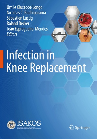 Umile Giuseppe Longo, Nicolaas C. Budhiparama, Sébastien Lustig, Roland Becker, João Espregueira-Mendes - Infection in Knee Replacement, Häftad