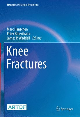 Knee Fractures 1