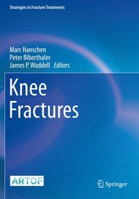 bokomslag Knee Fractures