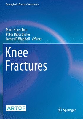 Marc Hanschen, Peter Biberthaler, James P. Waddell - Knee Fractures, Häftad