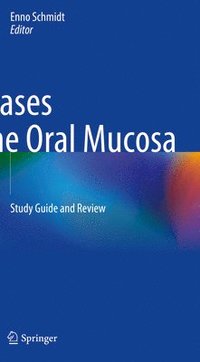 bokomslag Diseases of the Oral Mucosa