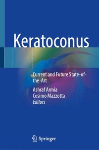 bokomslag Keratoconus
