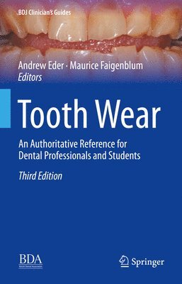 Tooth Wear 1