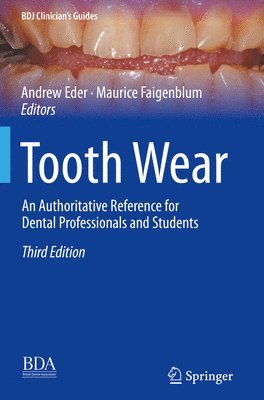 bokomslag Tooth Wear