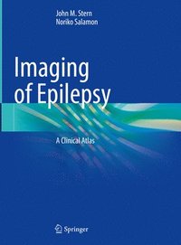 bokomslag Imaging of Epilepsy