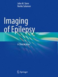 bokomslag Imaging of Epilepsy