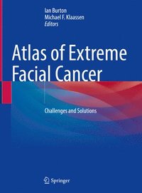 bokomslag Atlas of Extreme Facial  Cancer