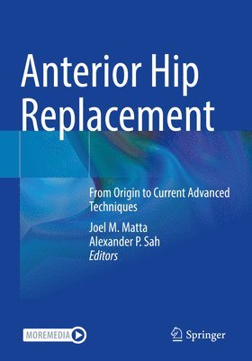 Anterior Hip Replacement 1