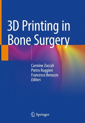 Carmine Zoccali, Pietro Ruggieri, Francesco Benazzo - 3D Printing in Bone Surgery, Inbunden