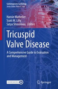 bokomslag Tricuspid Valve Disease