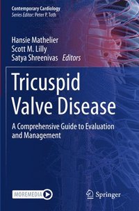 bokomslag Tricuspid Valve Disease