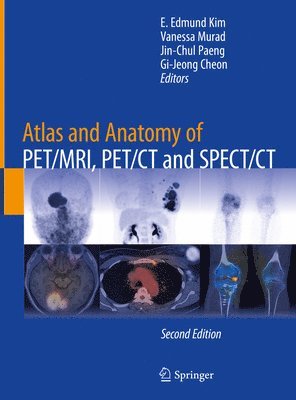 bokomslag Atlas and Anatomy of PET/MRI, PET/CT and SPECT/CT