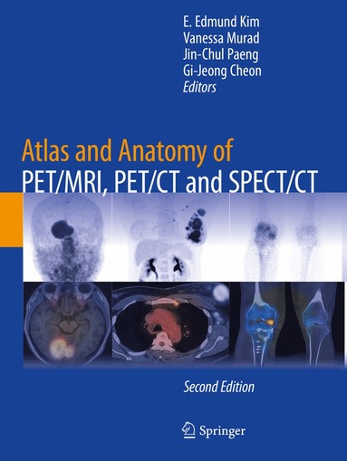 bokomslag Atlas and Anatomy of PET/MRI, PET/CT and SPECT/CT