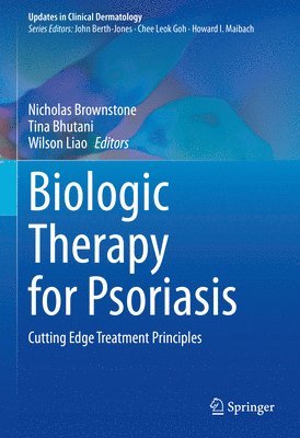 Biologic Therapy for Psoriasis 1