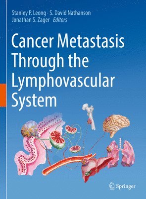 Cancer Metastasis Through the Lymphovascular System 1