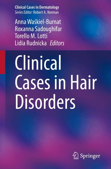 Anna Waśkiel-Burnat, Roxanna Sadoughifar, Torello M. Lotti, Lidia Rudnicka - Clinical Cases in Hair Disorders, Häftad
