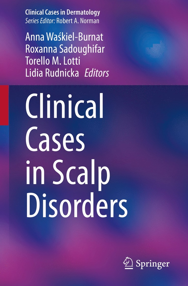 Anna Waśkiel-Burnat, Roxanna Sadoughifar, Torello M. Lotti, Lidia Rudnicka, Anna Waskiel-Burnat, Anna Wa&#347;kiel-Burnat, Anna Wa¿kiel-Burnat - Clinical Cases in Scalp Disorders, Häftad