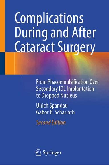 Ulrich Spandau, Gabor B. Scharioth - Complications During and After Cataract Surgery, Inbunden